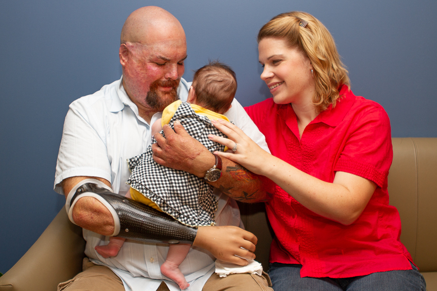 Parenting When You Have a Limb Difference: Babies